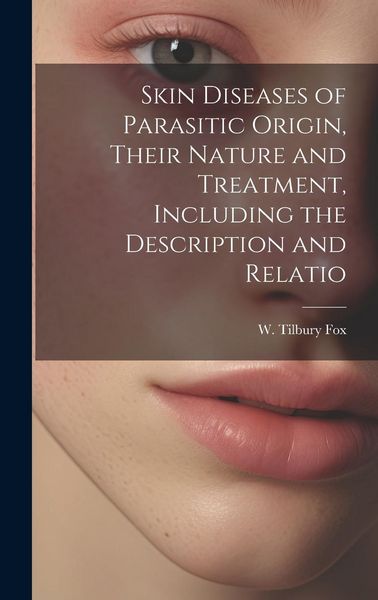 Produktbild: Skin Diseases of Parasitic Origin, Their Nature and Treatment, Including the Description and Relatio