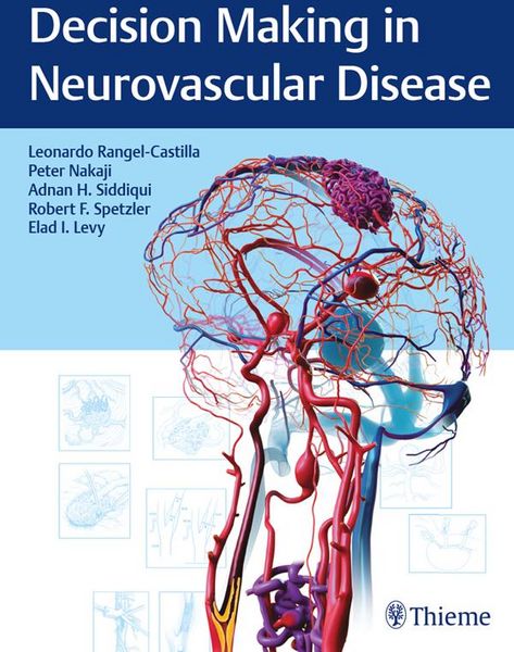Produktbild: Decision Making in Neurovascular Disease