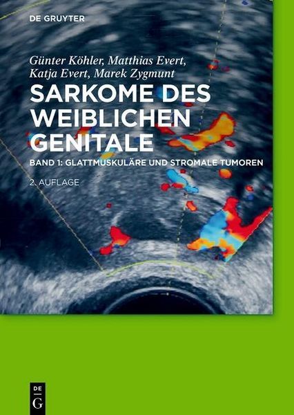 Produktbild: Glattmuskul&auml;re und stromale Tumoren