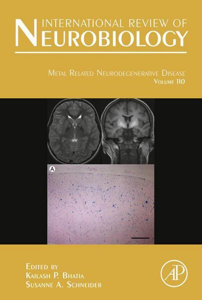 Produktbild: Metal Related Neurodegenerative Disease