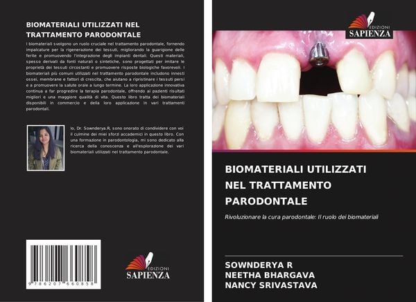 Produktbild: Biomateriali Utilizzati Nel Trattamento Parodontale