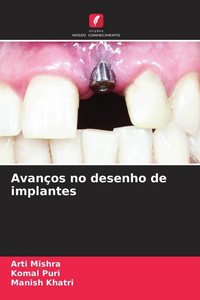 Produktbild: Avan&ccedil;os no desenho de implantes