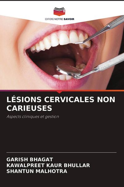 Produktbild: L&eacute;sions Cervicales Non Carieuses