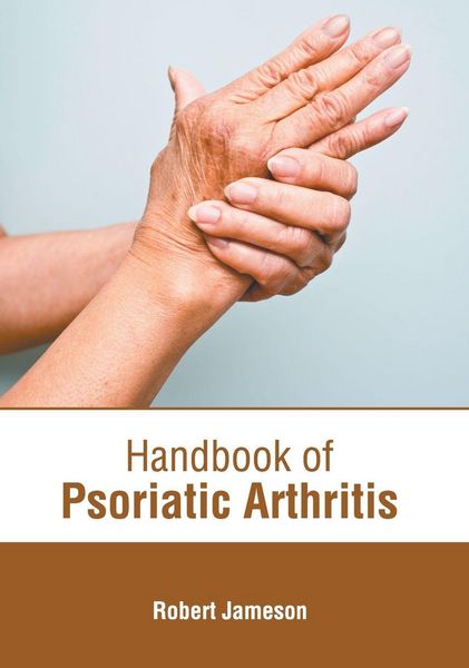 Produktbild: Handbook of Psoriatic Arthritis