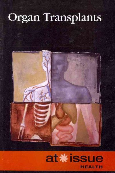 Produktbild: Organ Transplants