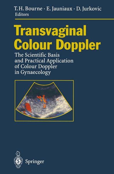 Produktbild: Transvaginal Colour Doppler