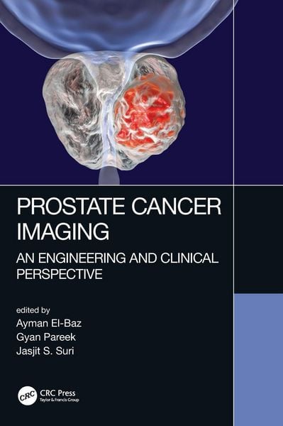 Produktbild: Prostate Cancer Imaging
