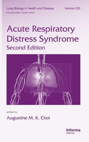 Produktbild: Acute Respiratory Distress Syndrome