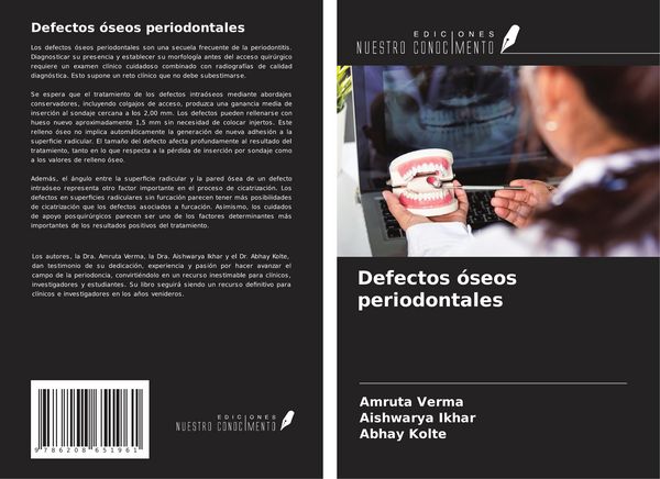 Produktbild: Defectos &oacute;seos periodontales