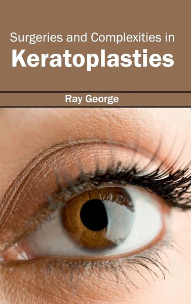 Produktbild: Surgeries and Complexities in Keratoplasties