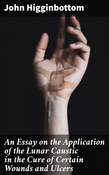 Produktbild: An Essay on the Application of the Lunar Caustic in the Cure of Certain Wounds and Ulcers