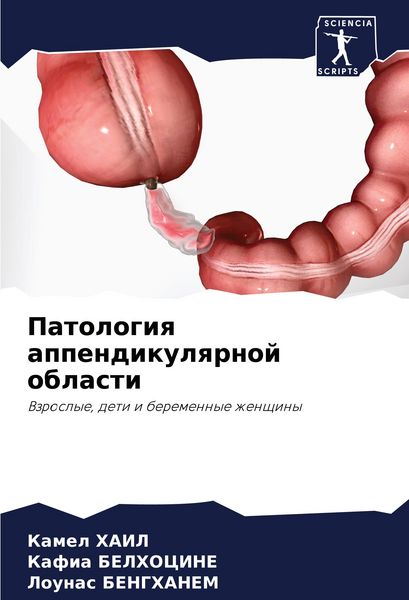 Produktbild: Patologiq appendikulqrnoj oblasti
