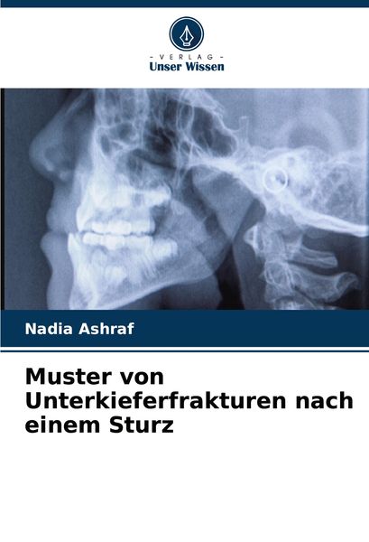 Muster von Unterkieferfrakturen nach einem Sturz