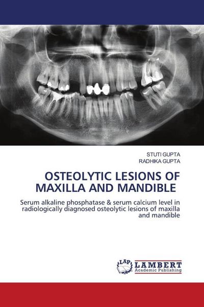 Produktbild: Osteolytic Lesions Of Maxilla and Mandible