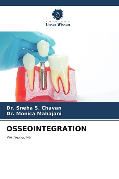 Produktbild: Osseointegration