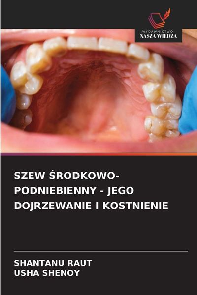Produktbild: Szew &iquest;rodkowo-Podniebienny - Jego Dojrzewanie I Kostnienie