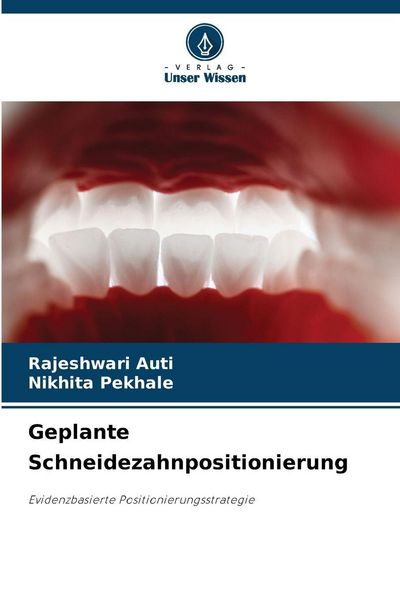 Produktbild: Geplante Schneidezahnpositionierung