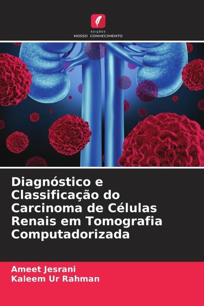 Produktbild: Diagn&oacute;stico e Classifica&ccedil;&atilde;o do Carcinoma de C&eacute;lulas Renais em Tomografia Computadorizada