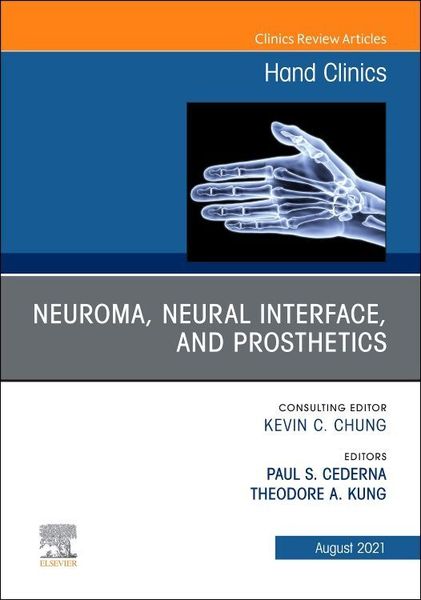 Produktbild: Neuroma, Neural Interface, and Prosthetics, an Issue of Hand Clinics