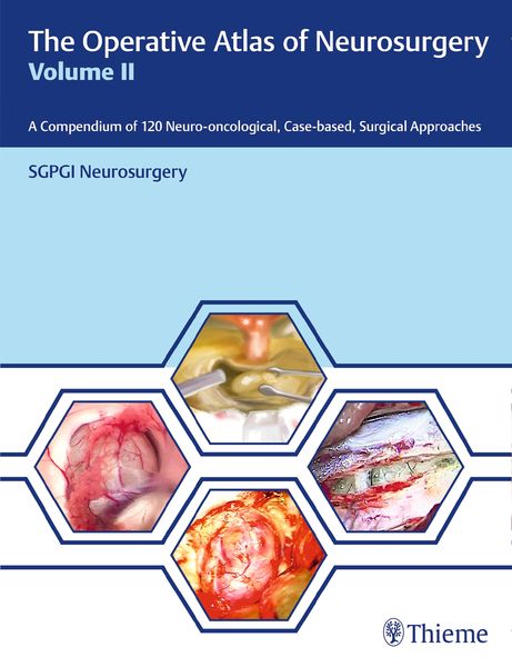 Produktbild: The Operative Atlas of Neurosurgery, Vol II