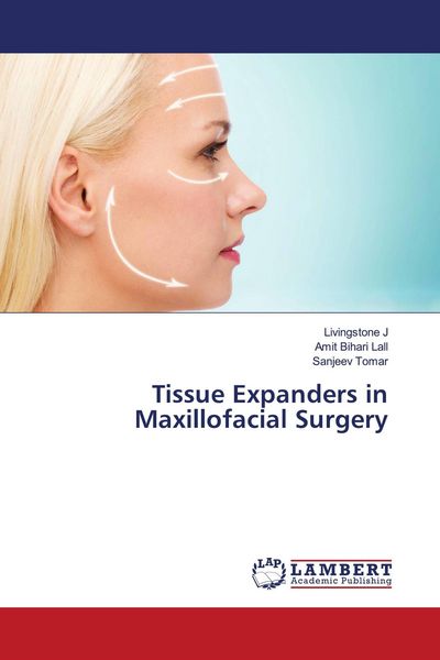 Produktbild: Tissue Expanders in Maxillofacial Surgery