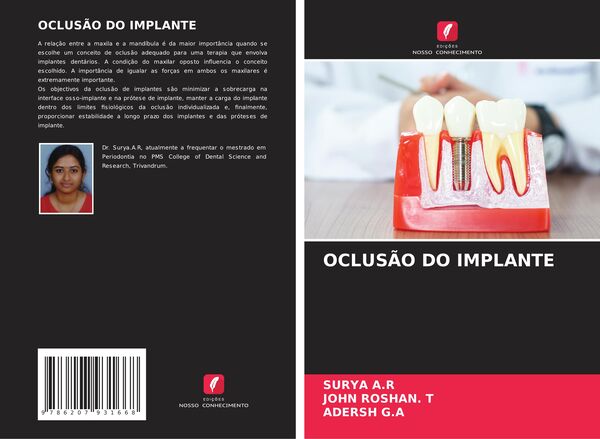 Produktbild: OCLUS&Atilde;O DO IMPLANTE
