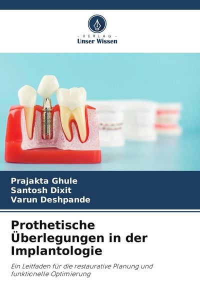Prothetische Überlegungen in der Implantologie, Taschenbuch von Prajakta Ghule , Santosh Dixit , Varun Deshpande, BoD - Books on Demand, 9786209614477
