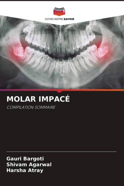 Produktbild: Molar Impac&eacute;