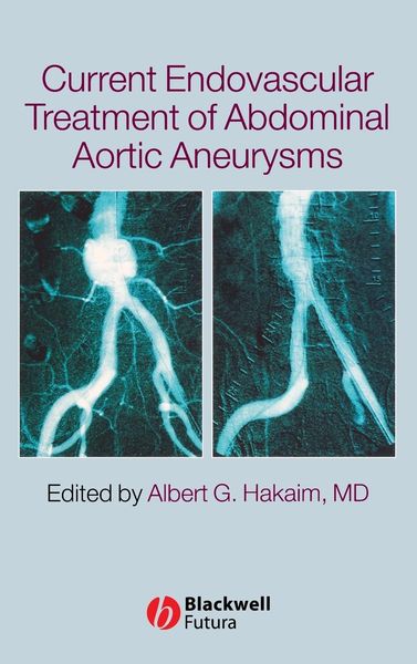 Produktbild: Current Endovascular Treatment of Abdominal Aortic Aneurysms