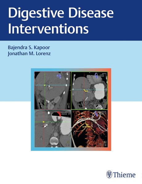 Produktbild: Digestive Disease Interventions