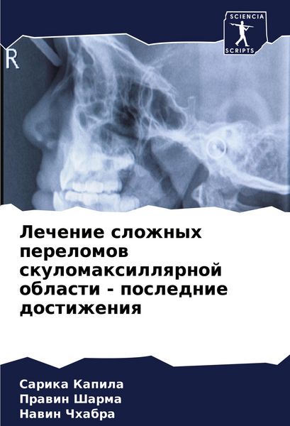 Produktbild: Lechenie slozhnyh perelomow skulomaxillqrnoj oblasti - poslednie dostizheniq
