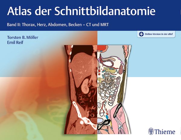 Produktbild: Atlas der Schnittbildanatomie