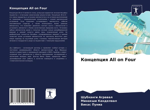 Produktbild: Koncepciq All on Four