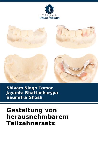 Gestaltung von herausnehmbarem Teilzahnersatz, Taschenbuch von Shivam Singh Tomar , Jayanta Bhattacharyya , Saumitra Ghosh, Verlag Unser Wissen,