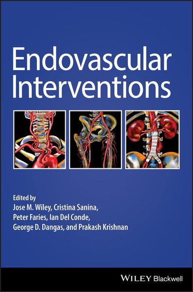 Produktbild: Endovascular Interventions