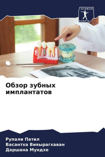 Produktbild: Obzor zubnyh implantatow
