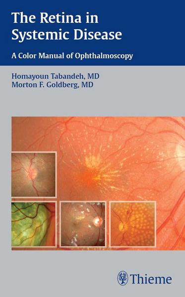 Produktbild: The Retina in Systemic Disease