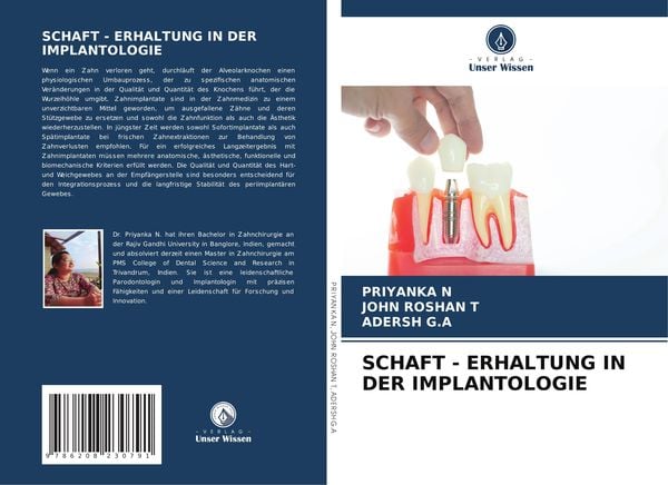 Schaft - Erhaltung in der Implantologie, Taschenbuch von Priyanka N. , John Roshan T. , Adersh G. A., Verlag Unser Wissen, 9786208230791