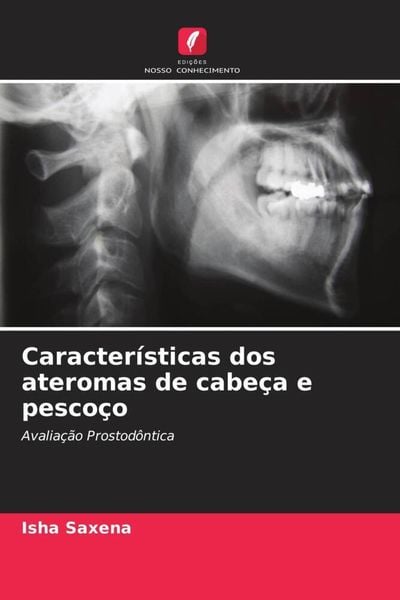 Produktbild: Caracter&iacute;sticas dos ateromas de cabe&ccedil;a e pesco&ccedil;o