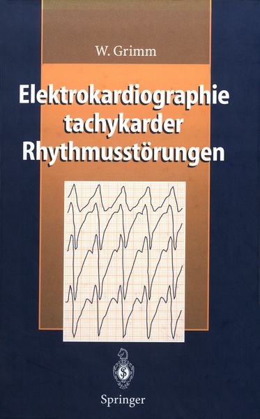 Produktbild: Elektrokardiographie tachykarder Rhythmusst&ouml;rungen
