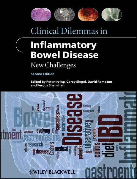 Produktbild: Clinical Dilemmas in Inflammatory Bowel Disease