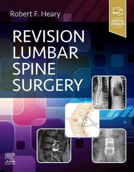 Produktbild: Revision Lumbar Spine Surgery