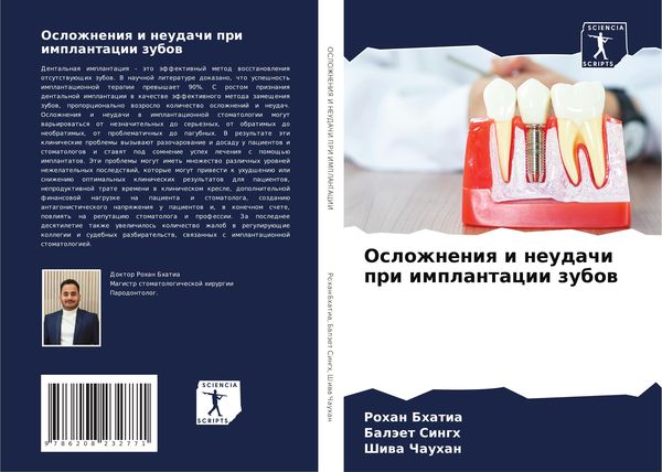 Produktbild: Oslozhneniq i neudachi pri implantacii zubow