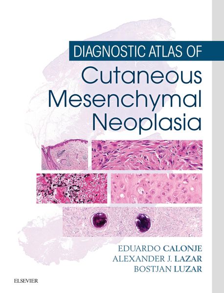 Produktbild: Diagnostic Atlas of Cutaneous Mesenchymal Neoplasia E-Book