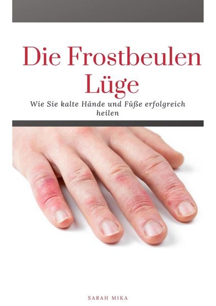 Produktbild: Die Frostbeulen L&uuml;ge