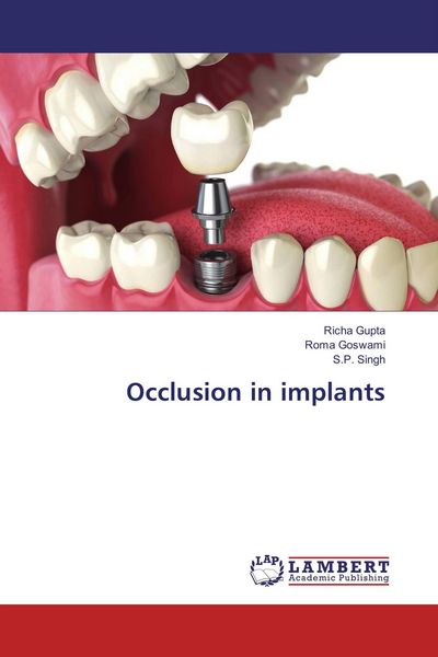 Produktbild: Occlusion in implants