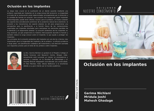 Produktbild: Oclusi&oacute;n en los implantes