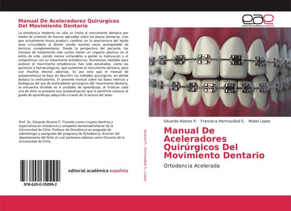 Produktbild: Manual De Aceleradores Quir&uacute;rgicos Del Movimiento Dentario