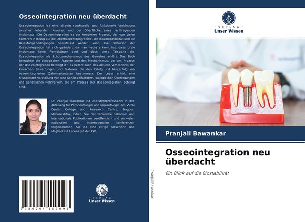 Osseointegration neu überdacht, Taschenbuch von Pranjali Bawankar, Verlag Unser Wissen, 9786204159096