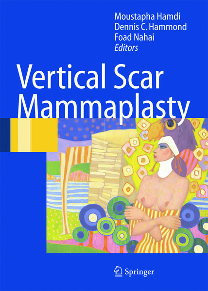 Produktbild: Vertical Scar Mammaplasty